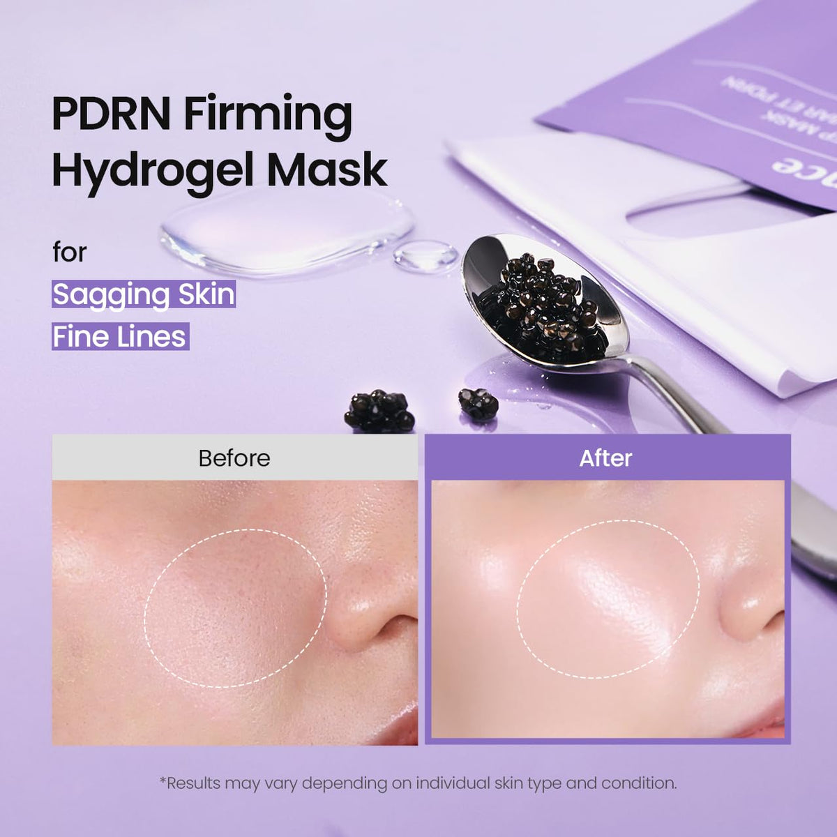BIODANCE Rejuvenating Caviar PDRN Real Deep Mask 34g (1 Piece)