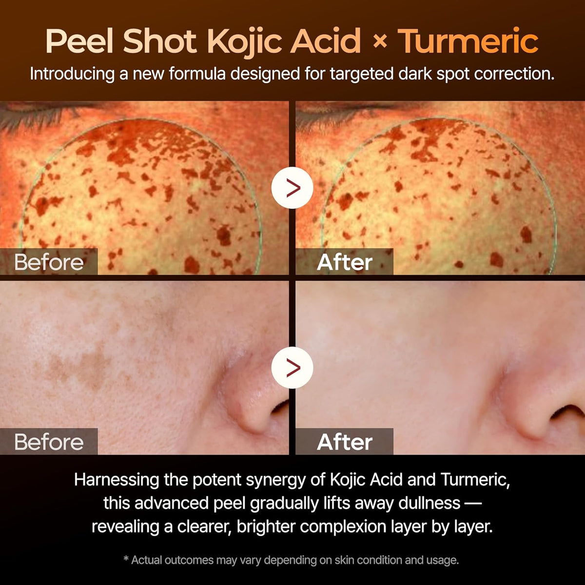 Dr Melaxin Peel Shot Exfoliating Kojic Acid Turmeric Serum 80ml