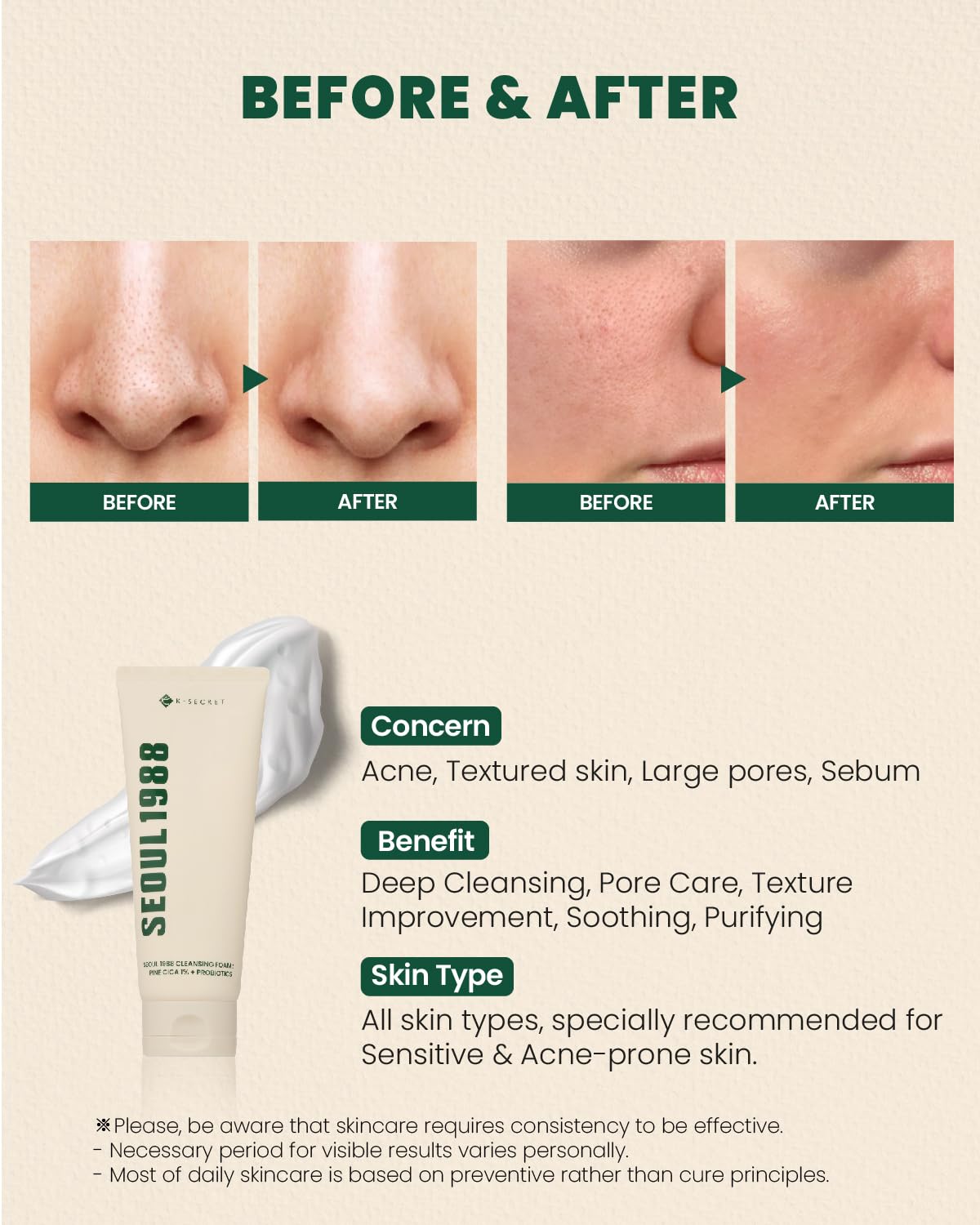KSECRET SEOUL 1988 Cleansing Foam Pine Cica 1% + Probiotics 150ml