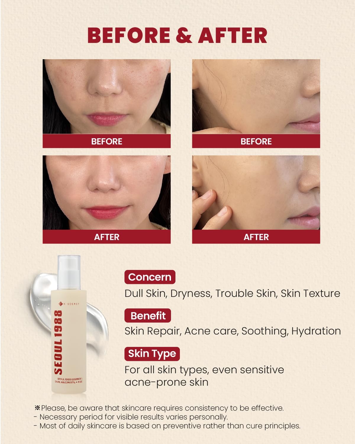 KSECRET SEOUL 1988 Essence Snail Mucin 97% + Rice 100ml
